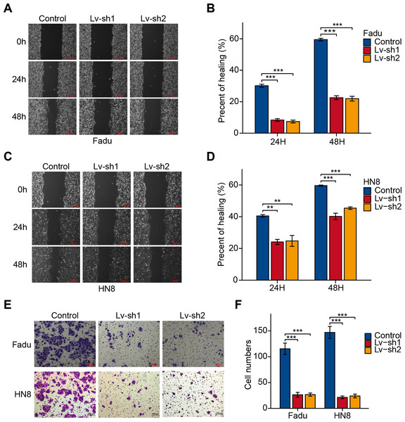 FTH1 inhibition suppressed HNSCC cell migration.