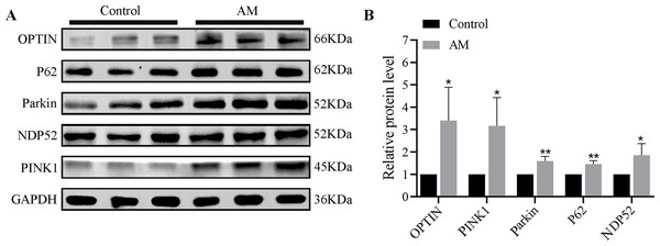 (A–B) Protein expression of PINK1/Parkin mitophagy pathway (n = 3 per group).