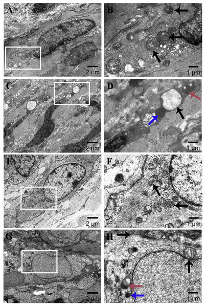 Ultrastructural changes of eutopic endometrium (×2k, ×6k).