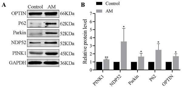 (A–B) Protein expression of PINK1/Parkin-mediated mitophagy pathway detected by Western blot in mouse uterine tissues (n = 6 per group).