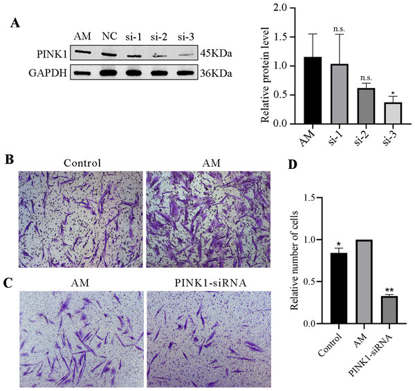 PINK1-siRNA and Transwell invasion assay.