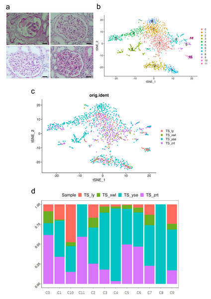 Pathological changes and global renal cell atlas of renal tissues.