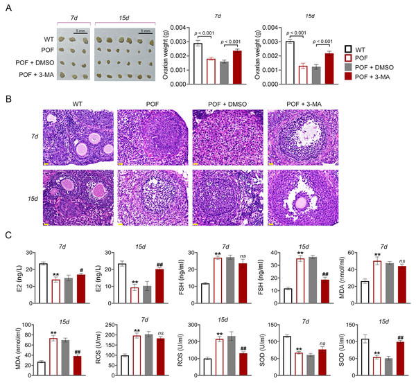 Inhibition of autophagy reduced oxidative stress and recovered ovarian function in premature ovarian failure (POF) mice.