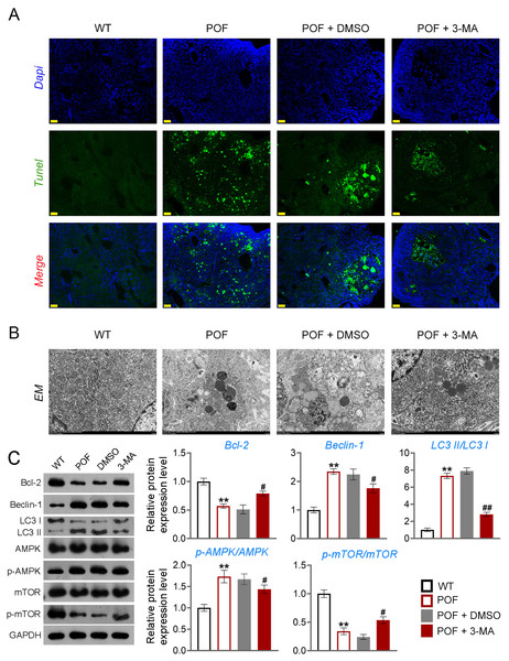 Inhibition of autophagy alleviated pathological injury and granulosa cell (GC) apoptosis in POF mice by retarding the AMPK/mTOR pathway.