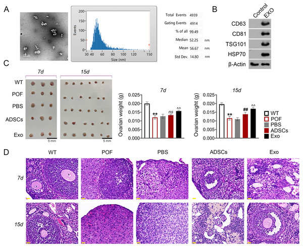Adipose mesenchymal stem cell-derived exosomes (ADSCs-Exo) ameliorated chemotherapy-induced pathological damage in POF mice.