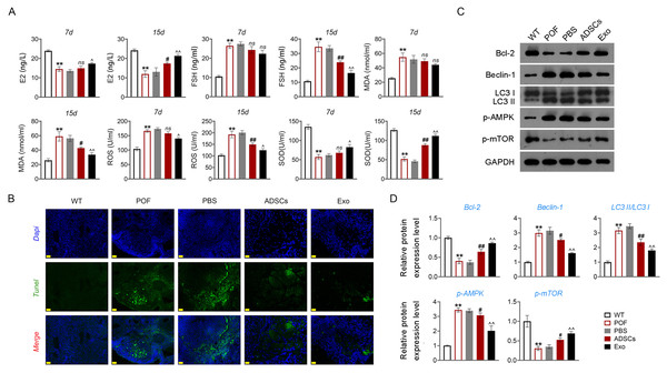 ADSCs-Exo inhibited GC apoptosis and autophagy by suppressing the AMPK/mTOR pathway.