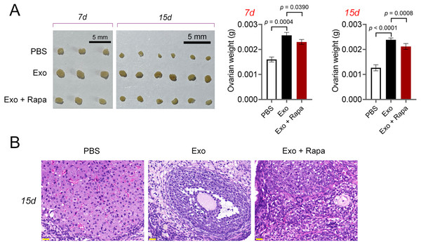ADSCs-Exo alleviated pathological injury in POF mice by inhibiting mTOR-mediated autophagy.