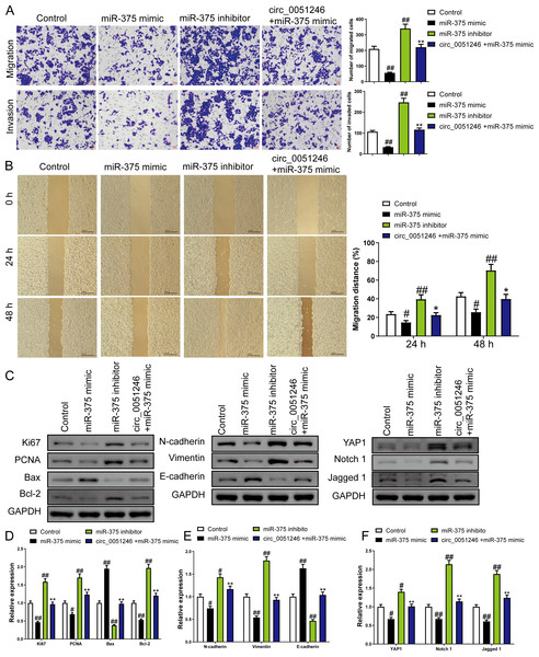 The circ_0051246 inhibited the effects of miR-375 on cell migration, invasion, and related proteins in gastric cancer stem cells (CSCs) (n= 3, mean ± SD).