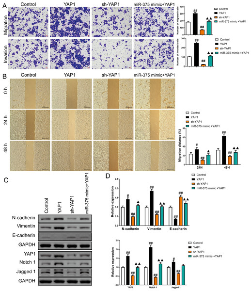 MiR-375 inhibited the effects of YAP1 on cell migration, invasion, and related proteins in SGC-7901 cancer stem cells (CSCs) (n= 3, mean ± SD).