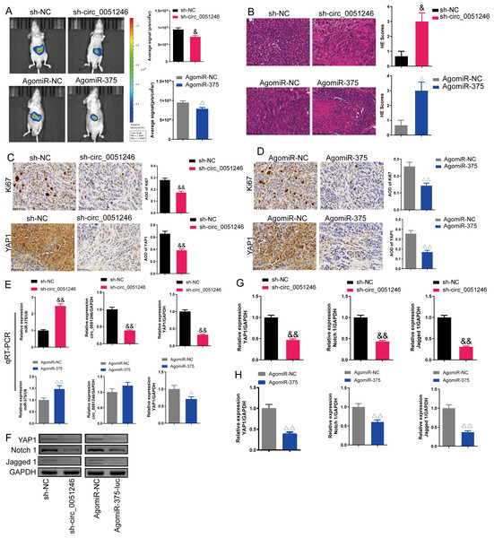 Effects of circ_0051246 and miR-375 on SGC-7901 cancer stem cells (CSCs) in vivo.