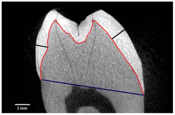 Measurement and reference lines in a Cercocebus atys lower right third molar.