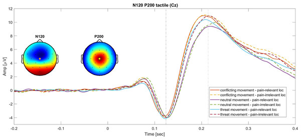 Grand average of the N120 and P200 SEPs at the Cz electrode.