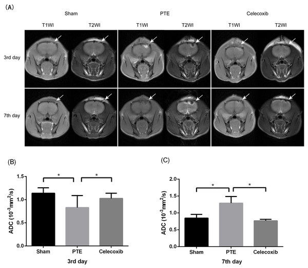 Change of magnetic resonance imaging (MRI) in post-traumatic epilepsy rats.