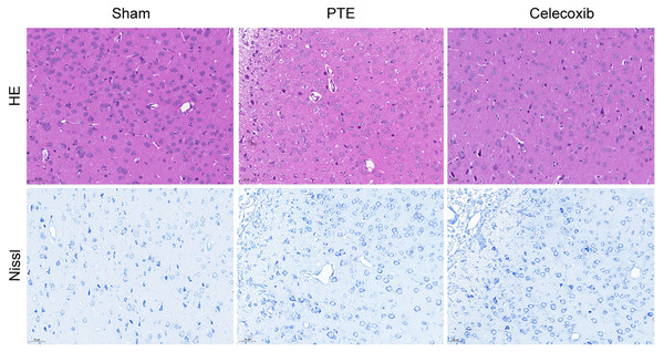 Pathological change of post-traumatic epilepsy rat.