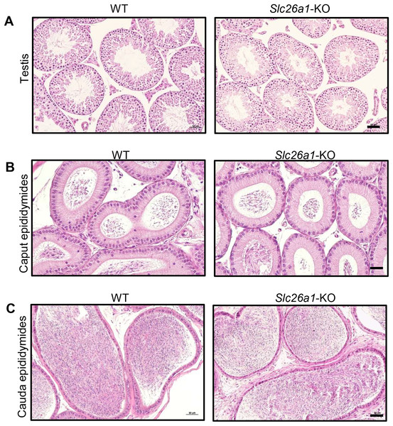Histological analysis of testes and epididymides from 8-week-old mice.