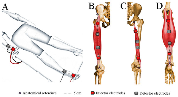 Electrode placement for bioelectrical impedance measurements in the whole-body (A), quadriceps (B), hamstrings (C), and calves (D).
