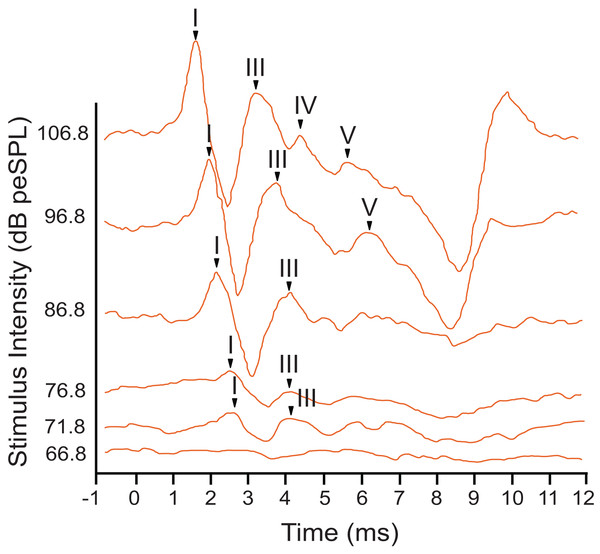 Representative ABR peakform in response to toneburst stimuli.