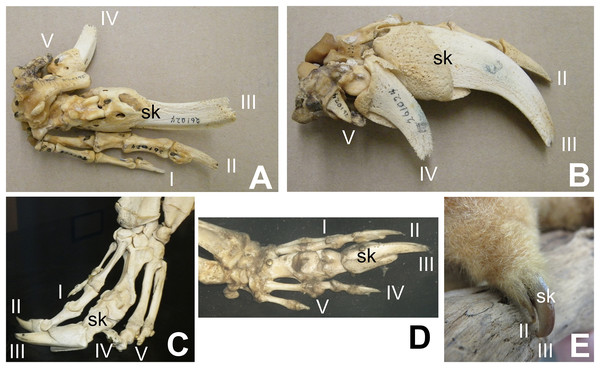 Digital proportions in skalodactylous mammals, showing reduction of fingers other than the skalodactyl.