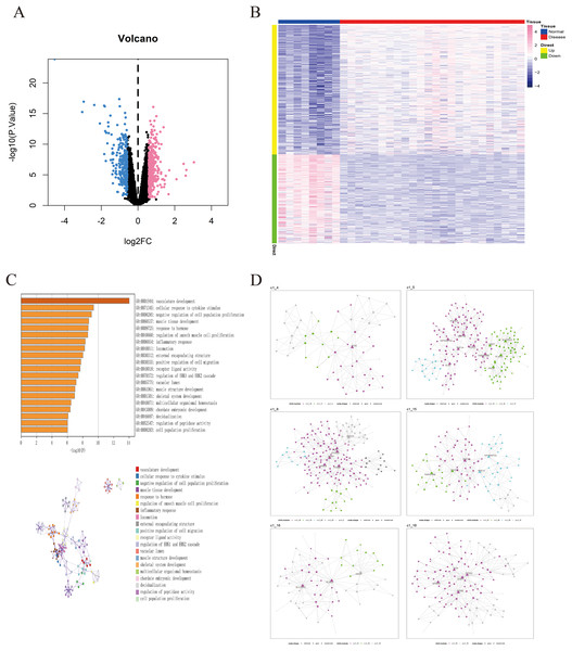Identification of differentially expressed genes in OSA.