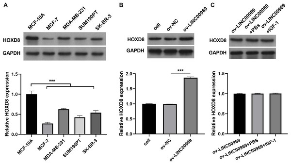 HOXD8 expression is regulated by LINC00969 in BC.