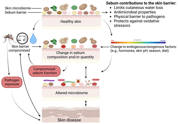 Mechanisms on how skin defenses with regards to sebum can fail and result in skin disease.