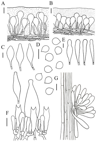 Microscopic features of Hymenopellis altissima..