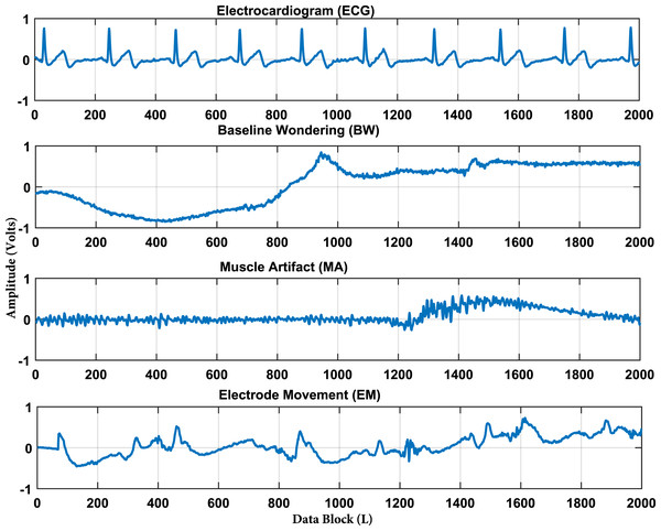 ECG and artifacts signals from MIT-BIH noise stress test database.