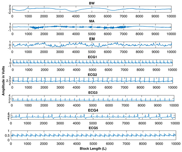 Source signals of ECG, BW, MA, and EM, downloaded from the MIT-BIH database.