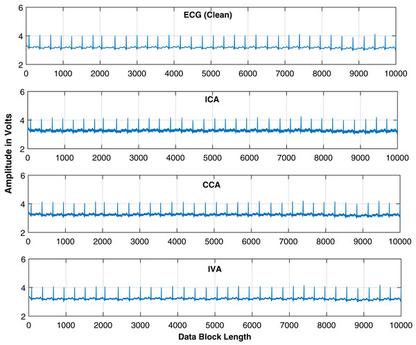 Extracted ECG signals are shown for the IVA-G, GMCA, and FastICA algorithms while utilizing block length of 10,000 samples.