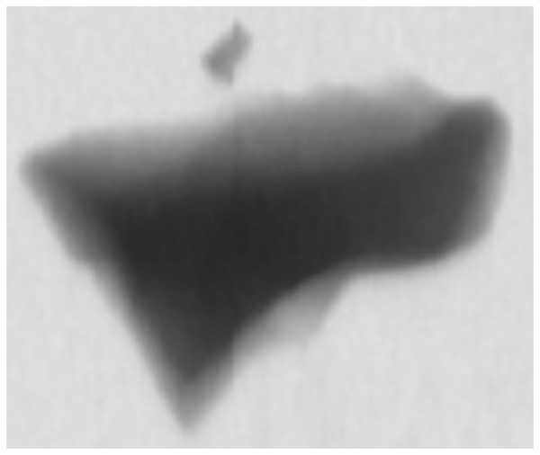 Gray image obtained from X-ray detector.