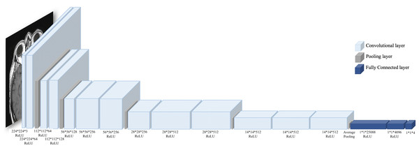 VGG16 architecture.