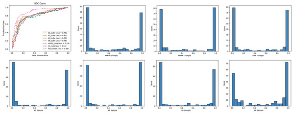 ROC curves and classification histogram for seven different models.