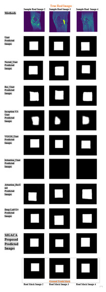 Example images of our MGACA method comparison with our other eight model results of real, ground truth, and predicted mask region location.