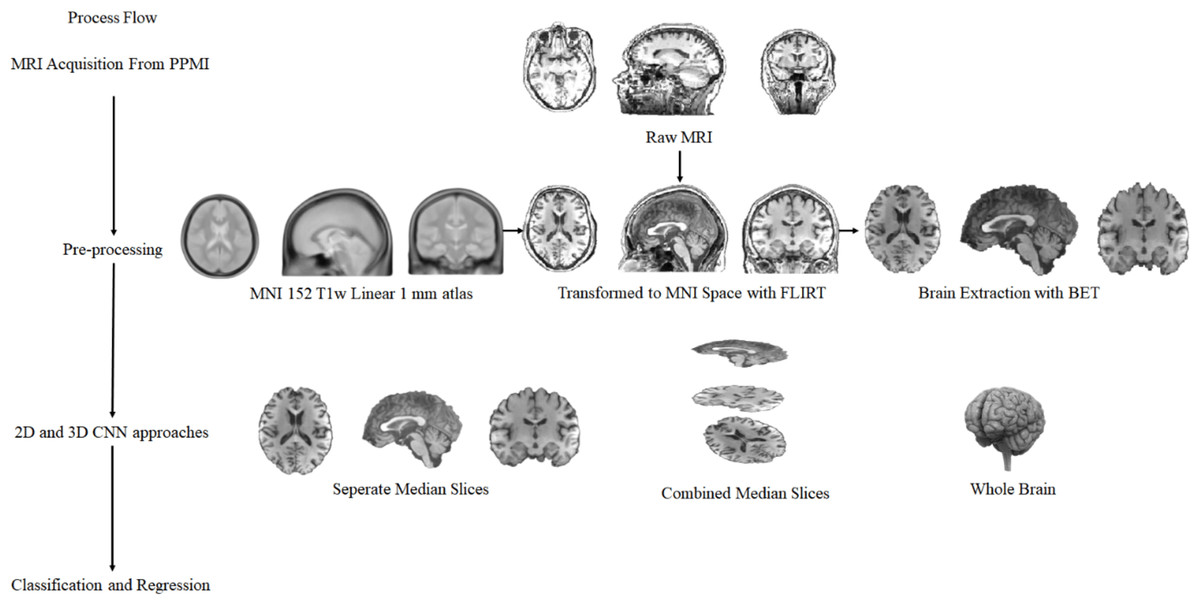 Motor Parkinson's disease and structure (Chapter 3) - Magnetic Resonance  Imaging in Movement Disorders