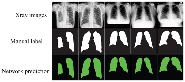 The segmentation results of the optimized model on the “Chest Xray Masks and Labels” dataset.