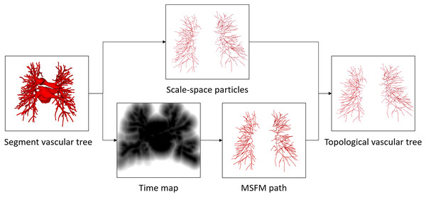 The proposed vessel tree topology extraction process.