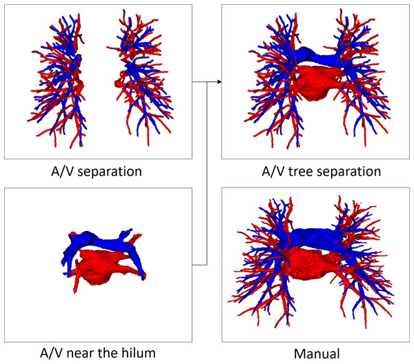 An example of manual separation and the A/V separation presented in this article.