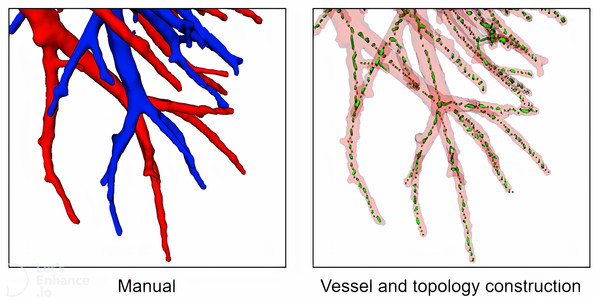 A case of local vessel and topology construction.