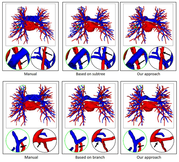 In an example of A/V separation results, the reconstructed results of different topology strategy optimizers.