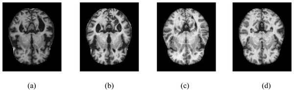 Samples of axial images in the Kaggle data set.