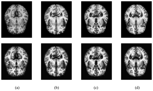 Samples of image pre-processing techniques in the Kaggle data set.