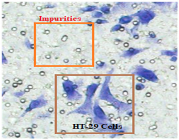 The blue shapes are HT-29 cells, and the others are impurities (Matrigel).