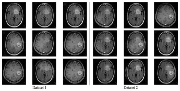 Fake image generated by CGAN on Dataset 1 and Dataset 2.