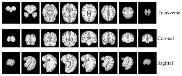 3D MRI data slicing in three directions.