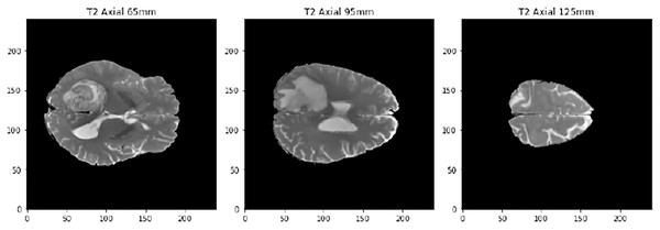 Example of the three cuts made to each image, corresponding to a T2-type scanner.