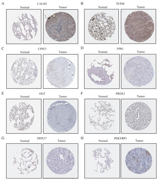 The protein-expression levels of eight NRGs in the HPA database based on immunohistochemistry analysis.