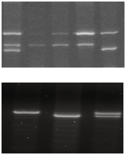 BDNF Val66Met polymorphism and the variable number tandem repeat (VNTR) at the 3′ end of the DAT1 gene affect the emotional response and the final score.