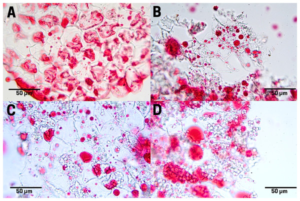 Lipid distribution in cachichín (Oecopetalum mexicanum Greenm. & C.H. Thomps.) seeds subjected to different treatments.