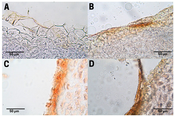 Protein distribution of cachichín (Oecopetalum mexicanum Greenm. & C.H. Thomps.) seeds subjected to different treatments.