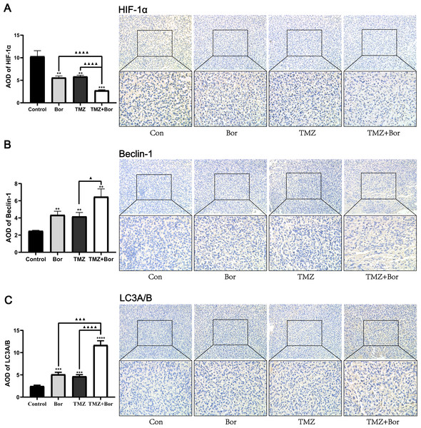 Immunohistochemical detection of HIF-1α, Beclin-1, and LC3A/B expression levels after treating gliomas with borneol (Bor) and temozolomide (TMZ).